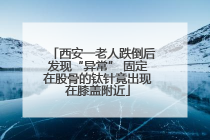 西安一老人跌倒后发现“异常” 固定在股骨的钛针竟出现在膝盖附近